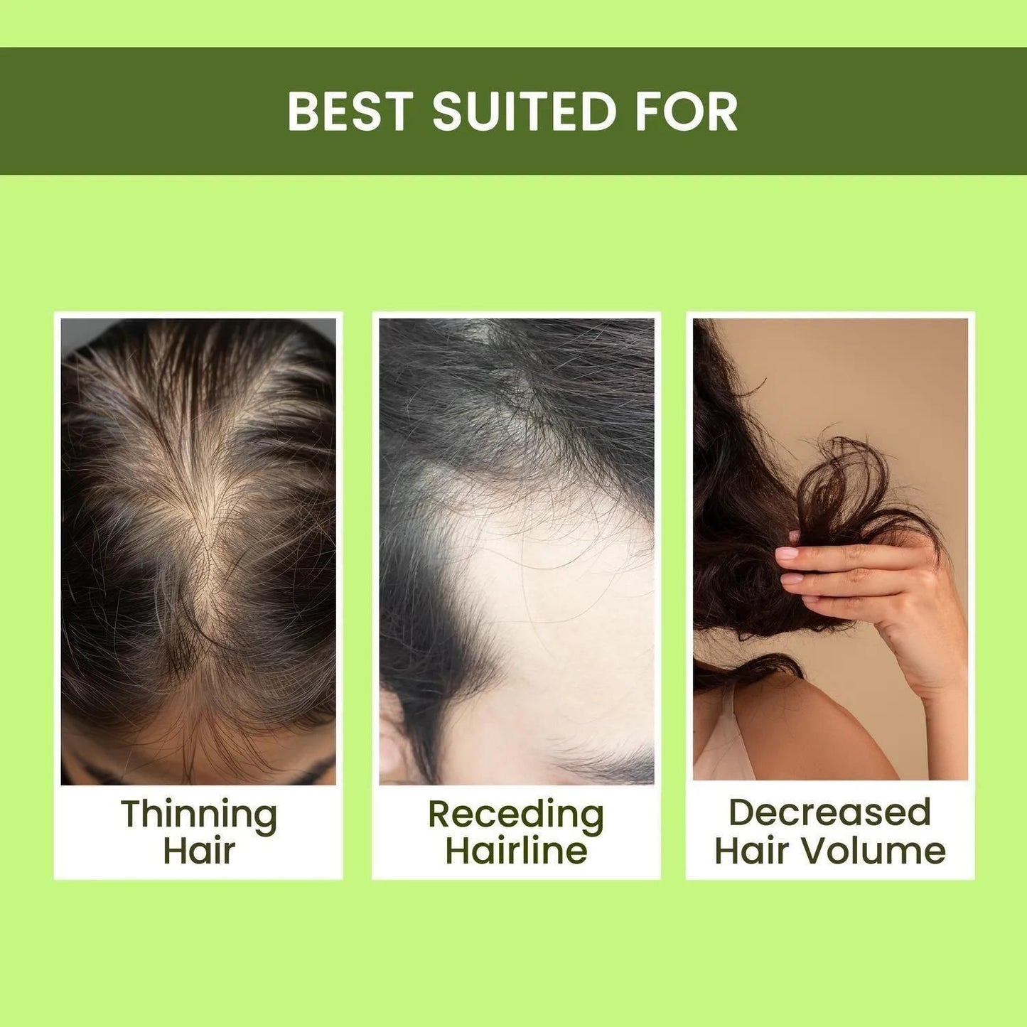 Rosemary Water, Hair Spray For Regrowth (Buy 1 + Get 2 Free)